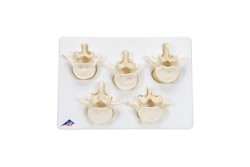 Zestaw 5 kręgów lędźwiowych BONE - 3B Smart Anatomy - 1000155 [A792]